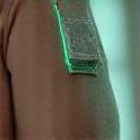 Miniaturní senzor pro kontinuální monitorování glukózy na rameni, s detaily kůže a jemným světlem.